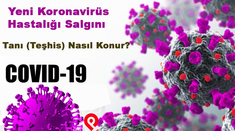 COVID-19 (Yeni Koronavirüs Hastalığı) Tanı Nasıl Konur?